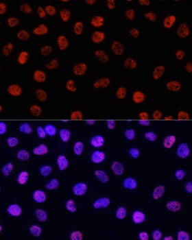 H3R26me2s Antibody