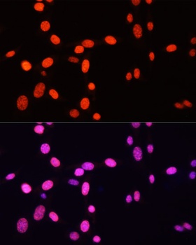 H3R26me2s Antibody