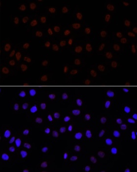 H3R26me2s Antibody