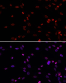 H3R26me2s Antibody