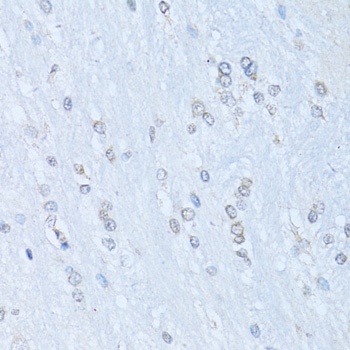 NFKB2 Antibody