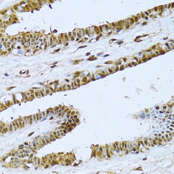 NFKB2 Antibody