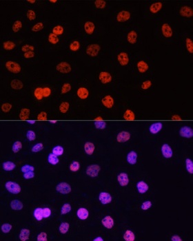 FLNB Antibody