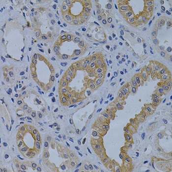 MVP Antibody