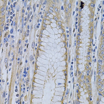 MVP Antibody