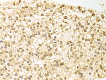 PLCB1 Antibody
