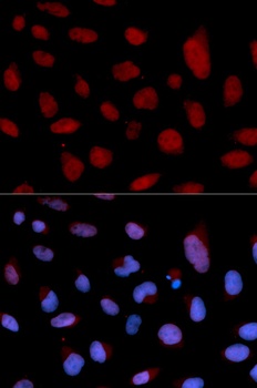 TNNC1 Antibody