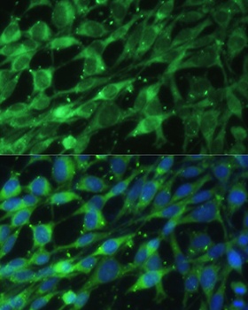 LMNA Antibody