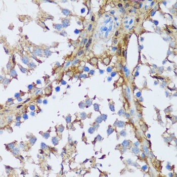 MAPK1/MAPK3 Antibody