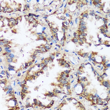 MAPK1/MAPK3 Antibody