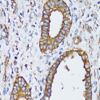 MAPK1/MAPK3 Antibody