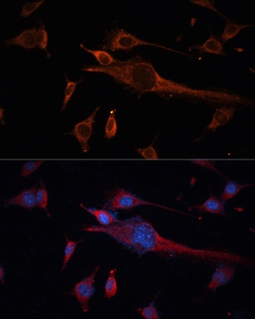 TUBB3 Antibody