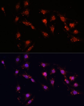 MKI67 Antibody