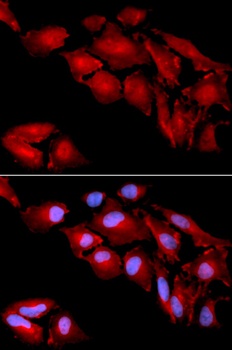 CTNND1 Antibody