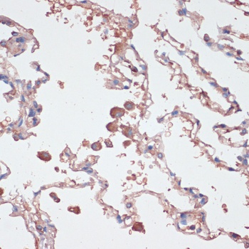 IL2 Antibody