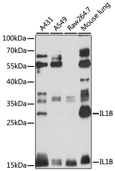 IL1B Antibody