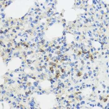 IL1B Antibody