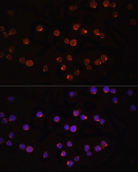 IL1B Antibody