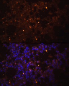 IL1B Antibody