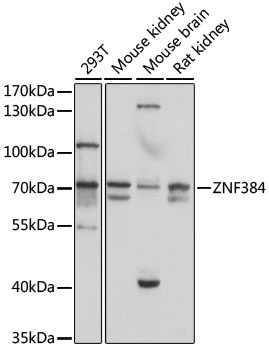 ZNF384 Antibody