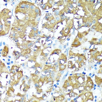 TNFRSF1A Antibody