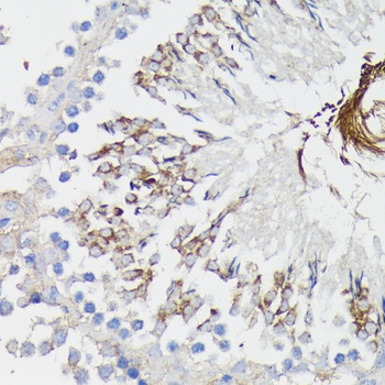 TNFRSF1A Antibody