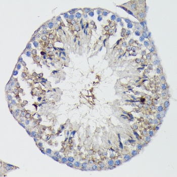 TNFRSF1A Antibody