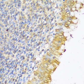 GLB1L3 Antibody