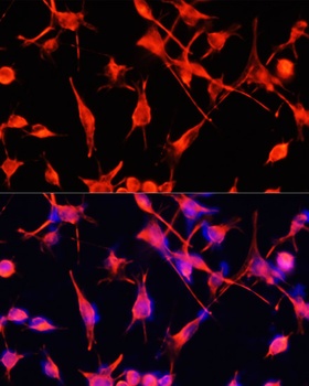 GFAP Antibody