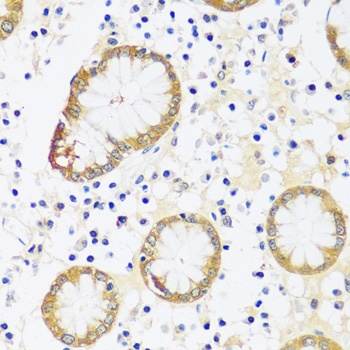 CAMK1 Antibody