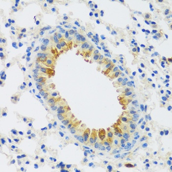 CAMK1 Antibody