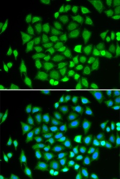 AKR7A2 Antibody