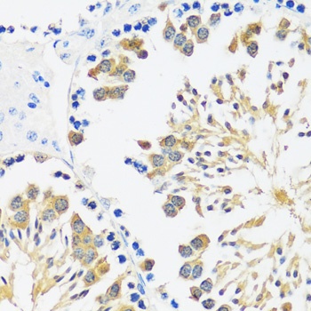 CALM3 Antibody