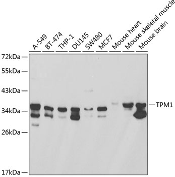 TPM1 Antibody