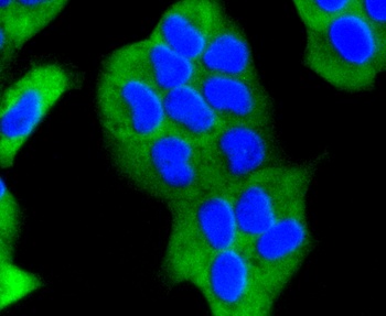 BRCA1 Antibody