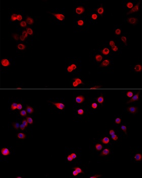 TNF Antibody