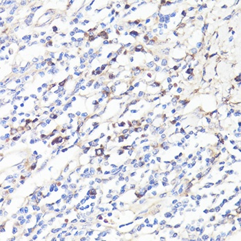 IL6 Antibody