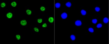 PRKCA Antibody