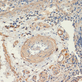 MYH11 Antibody