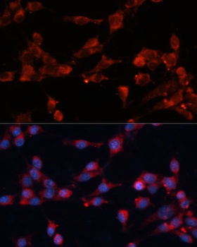 EIF3B Antibody