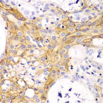 ACTA2 Antibody