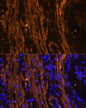 ACTA2 Antibody