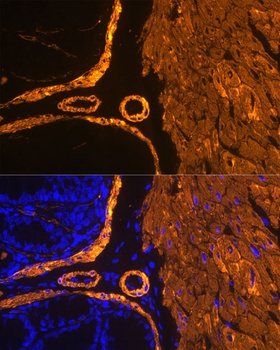 ACTA2 Antibody