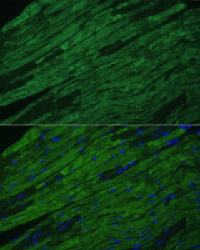 TNNI3 Antibody