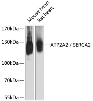 ATP2A2 Antibody