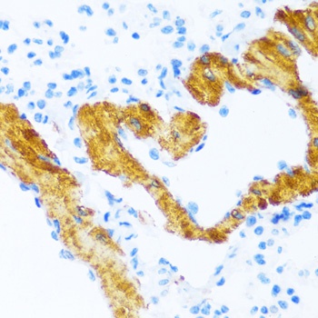 ATP2A2 Antibody
