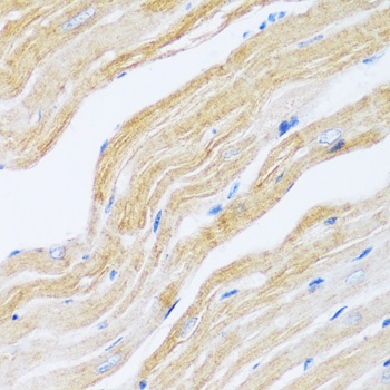 ATP2A2 Antibody