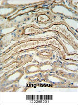 ADH7 Antibody