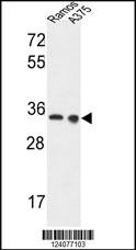 LDHA Antibody