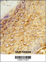 LDHA Antibody